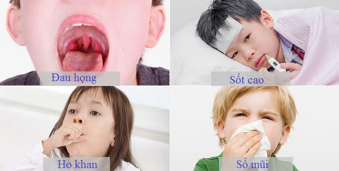 Triệu chứng viêm họng ở trẻ em