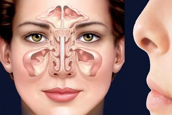 Nguyên nhân dẫn đến viêm xoang trán Nguyên nhân dẫn đến viêm xoang trán