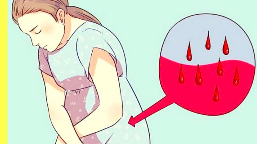 Sản dịch sau sinh là gì?