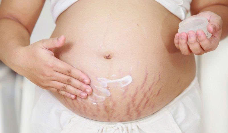 Nguyên nhân khiến mẹ bầu bị rạn da màu đỏ khi mang thai