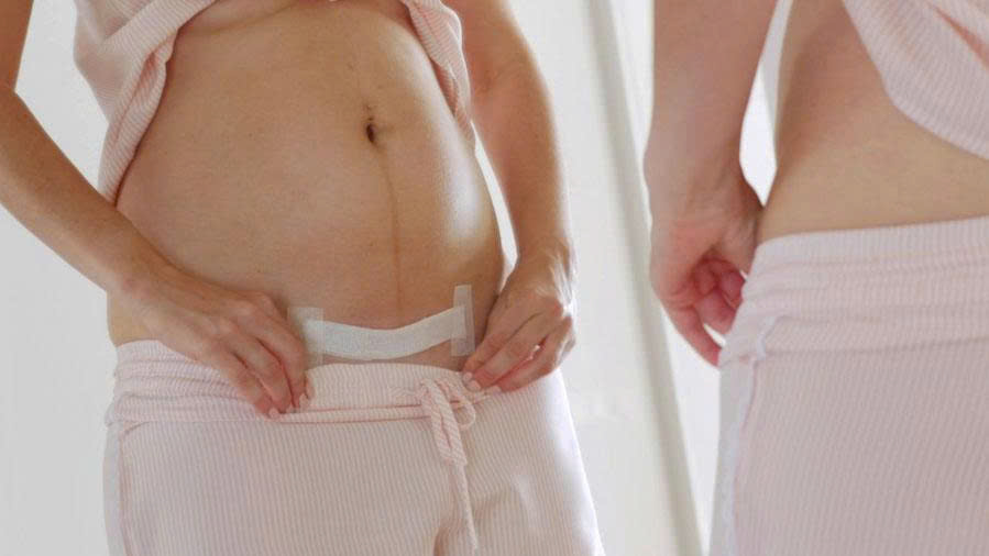 Chế độ nghỉ ngơi cho mẹ sau sinh mổ